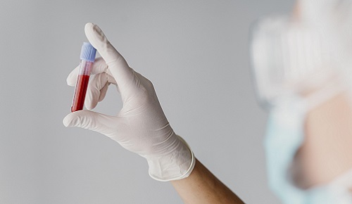¿Puede la sangre de alguien más joven ayudarnos a rejuvenecer? ¿Puede la sangre de alguien más joven ayudarnos a rejuvenecer?